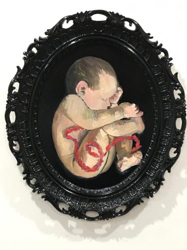 2020_Baby_in_womb_on_black_frame